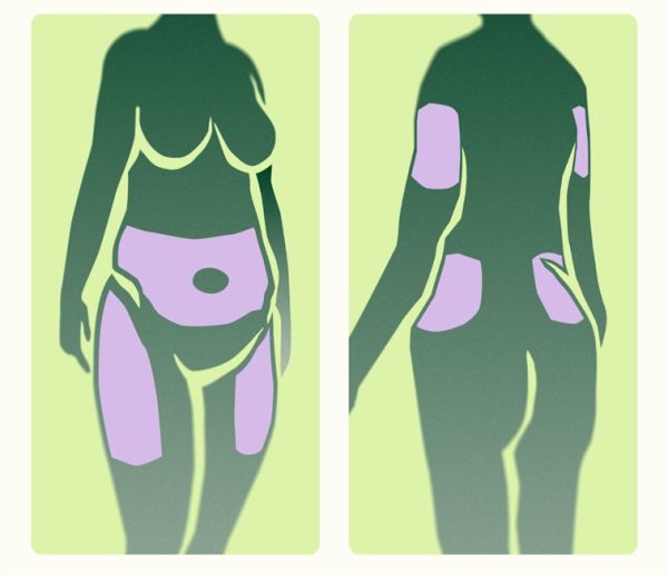 injection sites guide